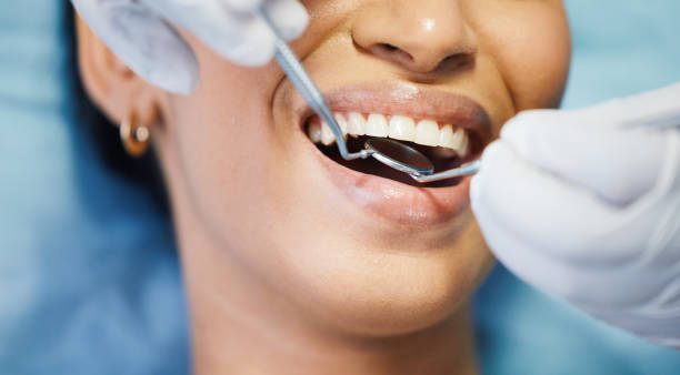 Best Emergency Dental Care for Abscessed Tooth in Jan Phyl Village, FL